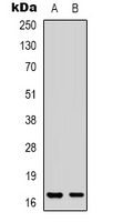 PPP1R14A / CPI-17 Antibody - Western blot analysis of CPI17 expression in Jurkat (A); HT29 (B) whole cell lysates.