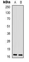 PPP1R14A / CPI-17 Antibody - Western blot analysis of CPI17 (pT38) expression in SHSY5Y (A); Raw264.7 (B) whole cell lysates.