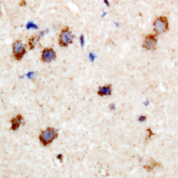 PPP1R14A / CPI-17 Antibody - Immunohistochemical analysis of CPI17 (pT38) staining in human brain formalin fixed paraffin embedded tissue section. The section was pre-treated using heat mediated antigen retrieval with sodium citrate buffer (pH 6.0). The section was then incubated with the antibody at room temperature and detected using an HRP polymer system. DAB was used as the chromogen. The section was then counterstained with hematoxylin and mounted with DPX.