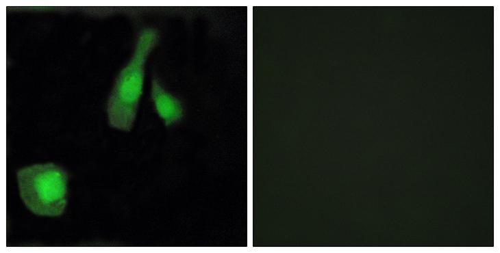 PPP1R14A / CPI-17 Antibody - Peptide - + Immunofluorescence analysis of HeLa cells, using CPI17a (Ab-38) antibody.