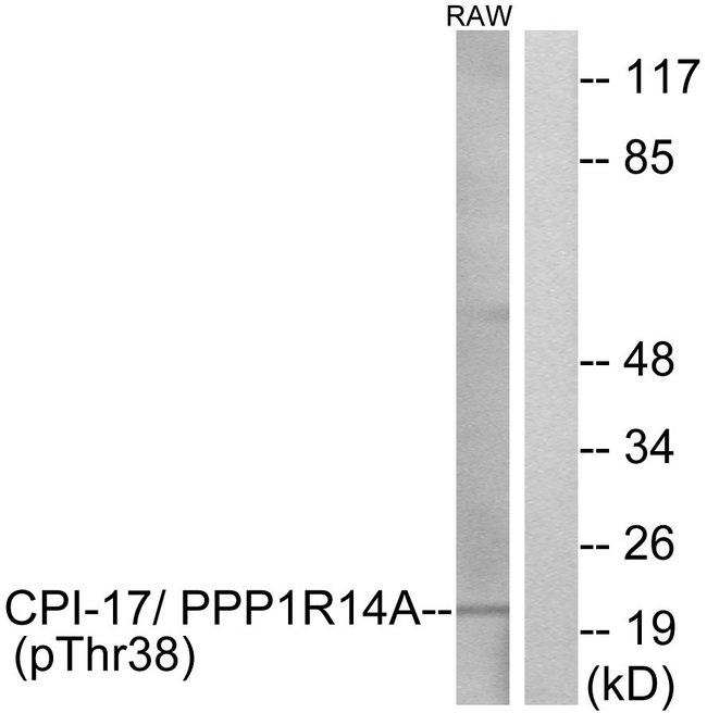 PPP1R14A / CPI-17 Antibody - Western blot analysis of lysates from RAW264.7 cells, using CPI17 alpha (Phospho-Thr38) Antibody. The lane on the right is blocked with the phospho peptide.