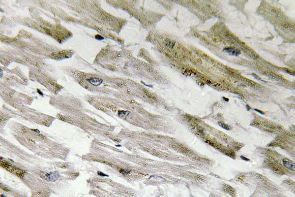 PPP1R14A / CPI-17 Antibody - IHC of p-CPI-17 (T38) pAb in paraffin-embedded human heart tissue.