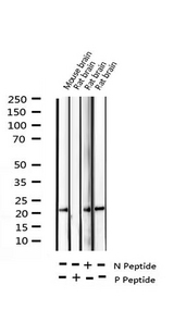 PPP1R14A / CPI-17 Antibody - Western blot analysis of Phospho-CPI17 alpha (Thr38) expression in various lysates