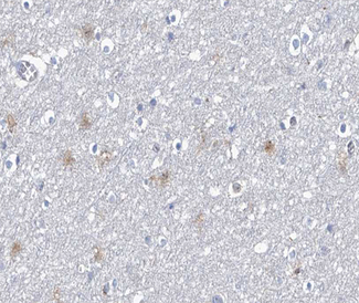 PPP1R14A / CPI-17 Antibody - 1:100 staining human brain tissue by IHC-P. The tissue was formaldehyde fixed and a heat mediated antigen retrieval step in citrate buffer was performed. The tissue was then blocked and incubated with the antibody for 1.5 hours at 22°C. An HRP conjugated goat anti-rabbit antibody was used as the secondary.