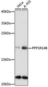 PPP1R14B Antibody - Western blot analysis of extracts of various cell lines, using PPP1R14B antibody at 1:1000 dilution. The secondary antibody used was an HRP Goat Anti-Rabbit IgG (H+L) at 1:10000 dilution. Lysates were loaded 25ug per lane and 3% nonfat dry milk in TBST was used for blocking. An ECL Kit was used for detection and the exposure time was 90s.