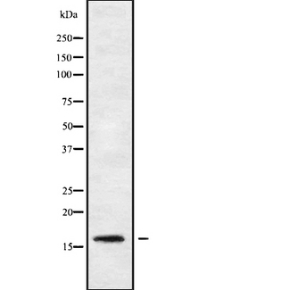 PPP1R14B Antibody - Western blot analysis of PPP1R14B using MCF-7 whole cells lysates
