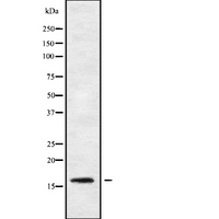 PPP1R14B Antibody - Western blot analysis of PPP1R14B using MCF-7 whole cells lysates