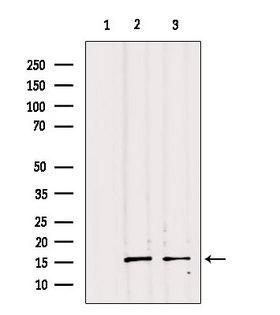 PPP1R14B Antibody - Western blot analysis of extracts of various samples using PPP1R14B antibody. Lane 1: 293 treated with blocking peptide. Lane 2: 293; Lane 3: c476;