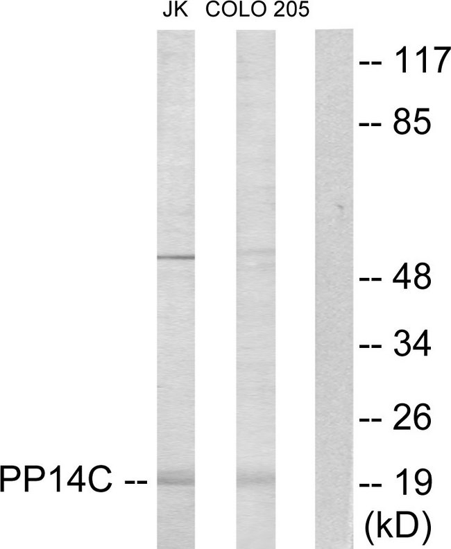 PPP1R14C / KEPI Antibody - Western blot analysis of lysates from Jurkat and COLO205 cells, using PPP1R14C Antibody. The lane on the right is blocked with the synthesized peptide.