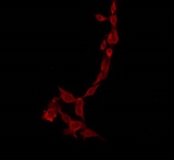 PPP1R14C / KEPI Antibody - Staining HeLa cells by IF/ICC. The samples were fixed with PFA and permeabilized in 0.1% Triton X-100, then blocked in 10% serum for 45 min at 25°C. The primary antibody was diluted at 1:200 and incubated with the sample for 1 hour at 37°C. An Alexa Fluor 594 conjugated goat anti-rabbit IgG (H+L) Ab, diluted at 1/600, was used as the secondary antibody.