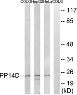 PPP1R14D / CPI17-Like Antibody - Western blot analysis of lysates from HeLa, HepG2, and COLO cells, using PPP1R14D Antibody. The lane on the right is blocked with the synthesized peptide.