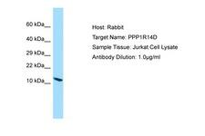 PPP1R14D / CPI17-Like Antibody -  This image was taken for the unconjugated form of this product. Other forms have not been tested.