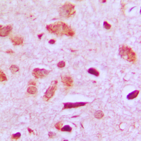 PPP1R14D / CPI17-Like Antibody - Immunohistochemical analysis of PPP1R14D staining in human brain formalin fixed paraffin embedded tissue section. The section was pre-treated using heat mediated antigen retrieval with sodium citrate buffer (pH 6.0). The section was then incubated with the antibody at room temperature and detected using an HRP conjugated compact polymer system. DAB was used as the chromogen. The section was then counterstained with hematoxylin and mounted with DPX.