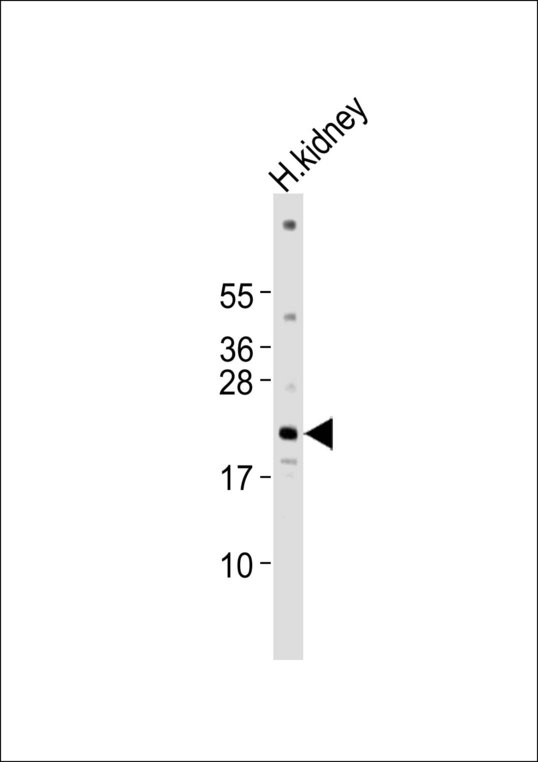 PPP1R14D / CPI17-Like Antibody - Anti-PPP1R14D Antibody at 1:1000 dilution + human kidney lysates Lysates/proteins at 20 ug per lane. Secondary Goat Anti-Rabbit IgG, (H+L),Peroxidase conjugated at 1/10000 dilution Predicted band size : 17 kDa Blocking/Dilution buffer: 5% NFDM/TBST.