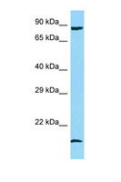 PPP1R15A / GADD34 Antibody - PPP1R15A / GADD34 antibody Western blot of Fetal Heart lysate. Antibody concentration 1 ug/ml.  This image was taken for the unconjugated form of this product. Other forms have not been tested.