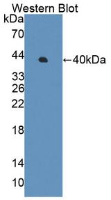 PPP1R15A / GADD34 Antibody - Western blot of PPP1R15A / GADD34 antibody.