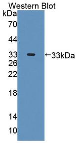 PPP1R15A / GADD34 Antibody - Western blot of PPP1R15A / GADD34 antibody.