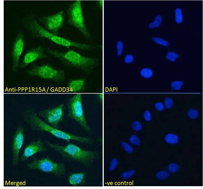 PPP1R15A / GADD34 Antibody - PPP1R15A / GADD34 antibody immunofluorescence analysis of paraformaldehyde fixed HeLa cells, permeabilized with 0.15% Triton. Primary incubation 1hr (10ug/ml) followed by Alexa Fluor 488 secondary antibody (4ug/ml), showing strong nuclear and some cytoplasmic staining. The nuclear stain is DAPI (blue). Negative control: Unimmunized goat IgG (10ug/ml) followed by Alexa Fluor 488 secondary antibody (2ug/ml).