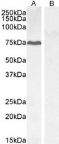 PPP1R15A / GADD34 Antibody - PPP1R15A / GADD34 antibody (0.3µg/ml) staining of HepG2 (A) and negative control KLY (B) lysate (35µg protein in RIPA buffer) Detected by chemiluminescence.