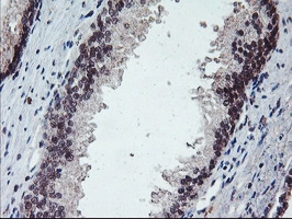 PPP1R15A / GADD34 Antibody - IHC of paraffin-embedded Human prostate tissue using anti-PPP1R15A mouse monoclonal antibody.