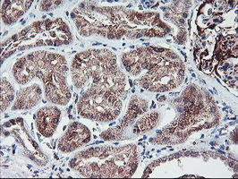 PPP1R15A / GADD34 Antibody - IHC of paraffin-embedded Human Kidney tissue using anti-PPP1R15A mouse monoclonal antibody.
