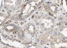 PPP1R15A / GADD34 Antibody - 1:100 staining human kidney tissue by IHC-P. The tissue was formaldehyde fixed and a heat mediated antigen retrieval step in citrate buffer was performed. The tissue was then blocked and incubated with the antibody for 1.5 hours at 22°C. An HRP conjugated goat anti-rabbit antibody was used as the secondary.