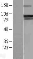 PPP1R15A / GADD34 Protein - Western validation with an anti-DDK antibody * L: Control HEK293 lysate R: Over-expression lysate