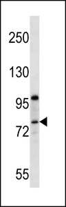 PPP1R15B Antibody - PR15B Antibody western blot of MCF-7 cell line lysates (35 ug/lane). The PR15B antibody detected the PR15B protein (arrow).