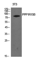 PPP1R15B Antibody - Western Blot analysis of extracts from NIH-3T3 cells using PPP1R15B Antibody.