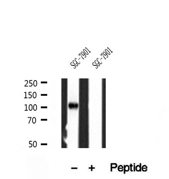 PPP1R15B Antibody - Western blot analysis of extracts of SGC-7901 cells using PPP1R15B antibody.