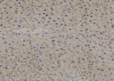 PPP1R15B Antibody - 1:100 staining mouse liver tissue by IHC-P. The sample was formaldehyde fixed and a heat mediated antigen retrieval step in citrate buffer was performed. The sample was then blocked and incubated with the antibody for 1.5 hours at 22°C. An HRP conjugated goat anti-rabbit antibody was used as the secondary.