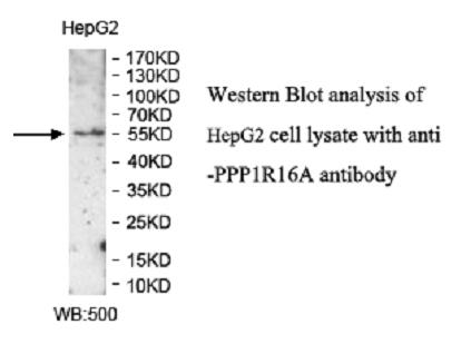 PPP1R16A Antibody - Western blot of PPP1R16A antibody