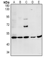 PPP1R16A Antibody - Western blot analysis of MYPT3 expression in HEK293T (A), A2780 (B), HCT116 (C), H9C2 (D), CT26 (E) whole cell lysates.