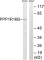 PPP1R16B Antibody - Western blot analysis of lysates from mouse brain, using PPP1R16B Antibody. The lane on the right is blocked with the synthesized peptide.