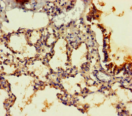 PPP1R16B Antibody - Immunohistochemistry of paraffin-embedded human lung tissue using PPP1R16B Antibody at dilution of 1:100