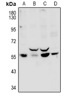 PPP1R16B Antibody - Western blot analysis of PPP1R16B expression in HEK293T (A), U87MG (B), C6 (C), CT26 (D) whole cell lysates.