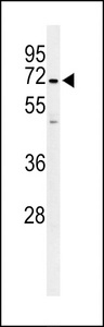 PPP1R18 Antibody - Western blot of PHTNS Antibody in Ramos cell line lysates (35 ug/lane). PHTNS (arrow) was detected using the purified antibody.