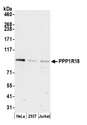 PPP1R18 Antibody - Detection of human PPP1R18 by western blot. Samples: Whole cell lysate (15 µg) from HeLa, HEK293T, and Jurkat cells prepared using NETN lysis buffer. Antibody: Affinity purified rabbit anti-PPP1R18 antibody used for WB at 1:1000. Detection: Chemiluminescence with an exposure time of 3 minutes.