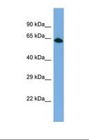 PPP1R18 Antibody - Western blot of Human HepG2. PPP1R18 antibody dilution 1.0 ug/ml.  This image was taken for the unconjugated form of this product. Other forms have not been tested.
