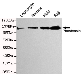 PPP1R18 Antibody - Western blot detection of Phostensin in HeLa, Raji, Ramos and Leucocyte cell lysates and using Phostensin mouse monoclonal antibody (1:200 dilution). Predicted band size: 120KDa. Observed band size: 120KDa.