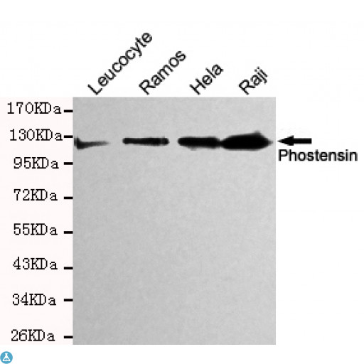 PPP1R18 Antibody - Western blot detection of Phostensin in Hela, Raji, Ramos and Leucocyte cell lysates and using Phostensin mouse mAb (1:200 diluted). Predicted band size: 120KDa. Observed band size: 120KDa.