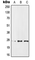 PPP1R1A / IPP1 Antibody - Western blot analysis of IPP1 expression in MCF7 (A); SP2/0 (B); PC12 (C) whole cell lysates.