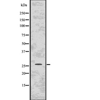 PPP1R1A / IPP1 Antibody - Western blot analysis of PPP1R1A using COS7 whole lysates.