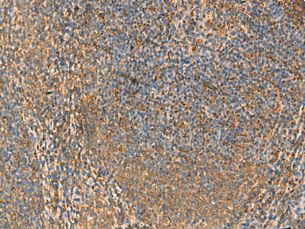PPP1R1A / IPP1 Antibody - Immunohistochemistry of paraffin-embedded Human tonsil tissue  using PPP1R1A Polyclonal Antibody at dilution of 1:50(×200)