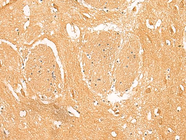 PPP1R1A / IPP1 Antibody - Immunohistochemistry of paraffin-embedded Human brain tissue  using PPP1R1A Polyclonal Antibody at dilution of 1:50(×200)
