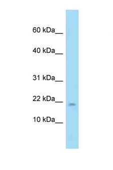 PPP1R1A / IPP1 Antibody - PPP1R1A antibody western blot of Mouse Pancreas lysate. Antibody concentration 1 ug/ml.  This image was taken for the unconjugated form of this product. Other forms have not been tested.