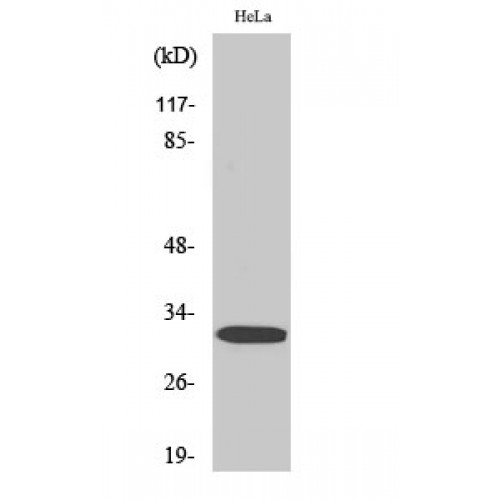 PPP1R1B / DARPP-32 Antibody - Western blot of Phospho-DARPP-32 (T75) antibody
