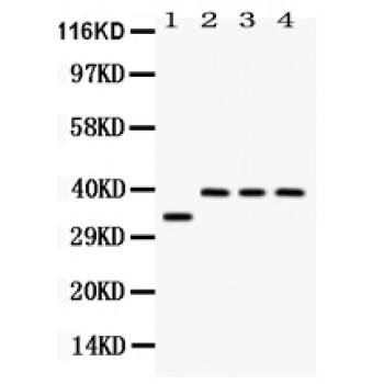 PPP1R1B / DARPP-32 Antibody - Western blot analysis of DARPP32 expression in rat brain extract (lane 1), SW620 whole cell lysates (lane 2), 22RV1 whole cell lysates (lane 3) and HELA whole cell lysates (lane 4). DARPP32 at 34 kD, 39 kD was detected using rabbit anti- DARPP32 Antigen Affinity purified polyclonal antibody at 0.5 ug/mL. The blot was developed using chemiluminescence (ECL) method.