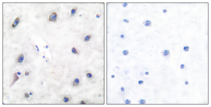 PPP1R1B / DARPP-32 Antibody - Immunohistochemistry analysis of paraffin-embedded human brain tissue, using DARPP-32 Antibody. The picture on the right is blocked with the synthesized peptide.