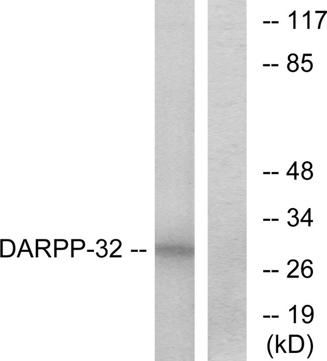 PPP1R1B / DARPP-32 Antibody - Western blot analysis of lysates from COS7 cells, treated with forskolin 40nM 30', using DARPP-32 Antibody. The lane on the right is blocked with the synthesized peptide.